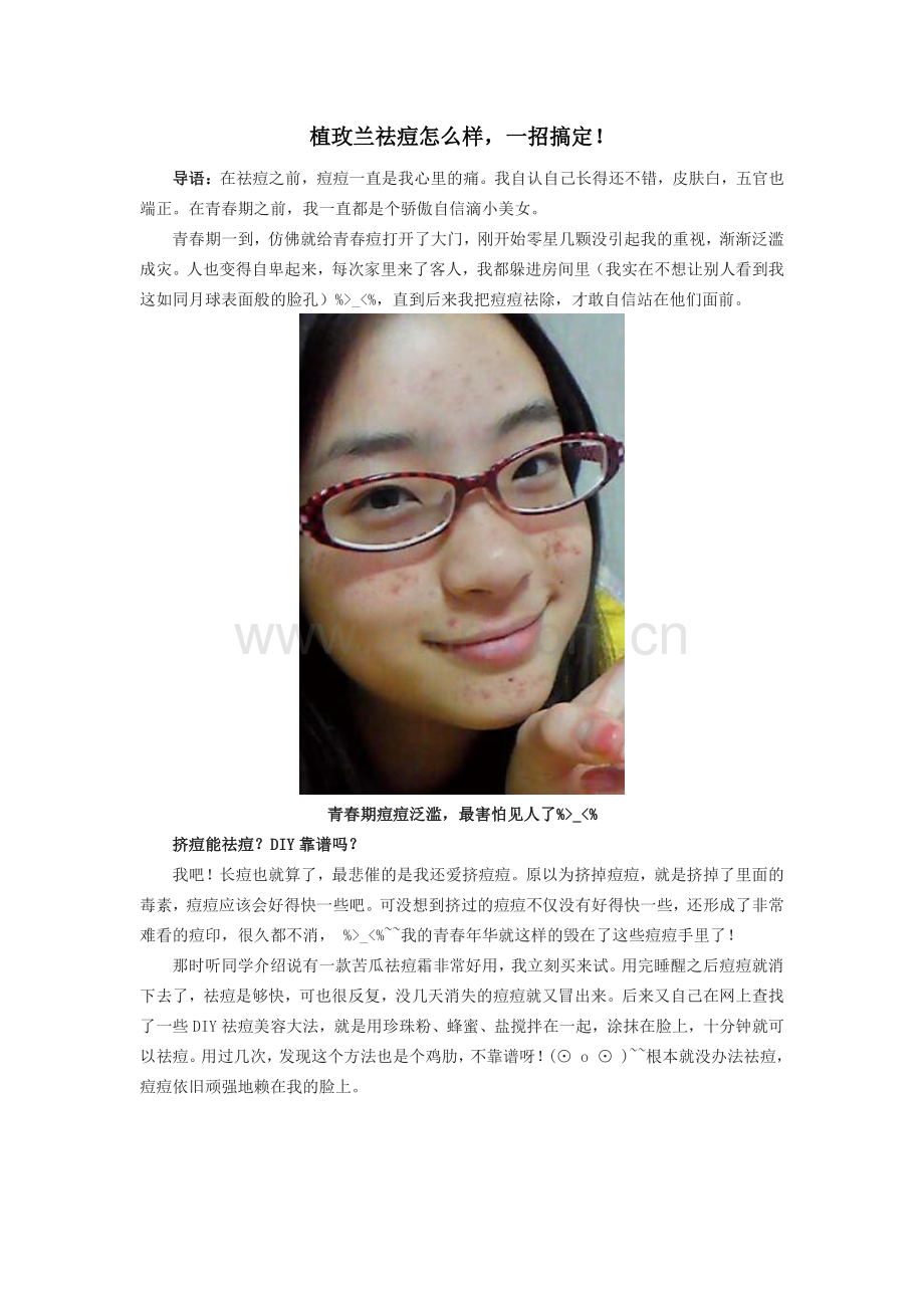 植玫兰祛痘怎么样,一招搞定!.pdf_第1页