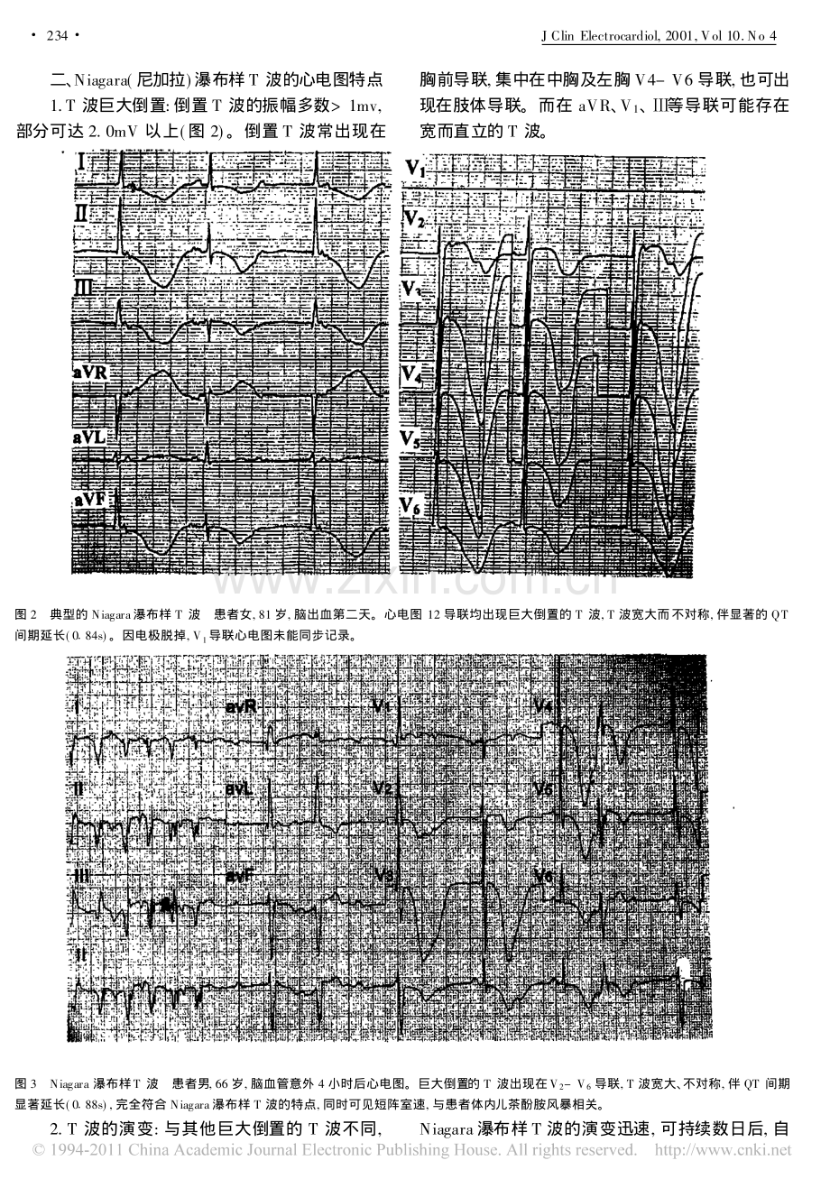 Niagara瀑布样T波_郭继鸿.pdf_第2页