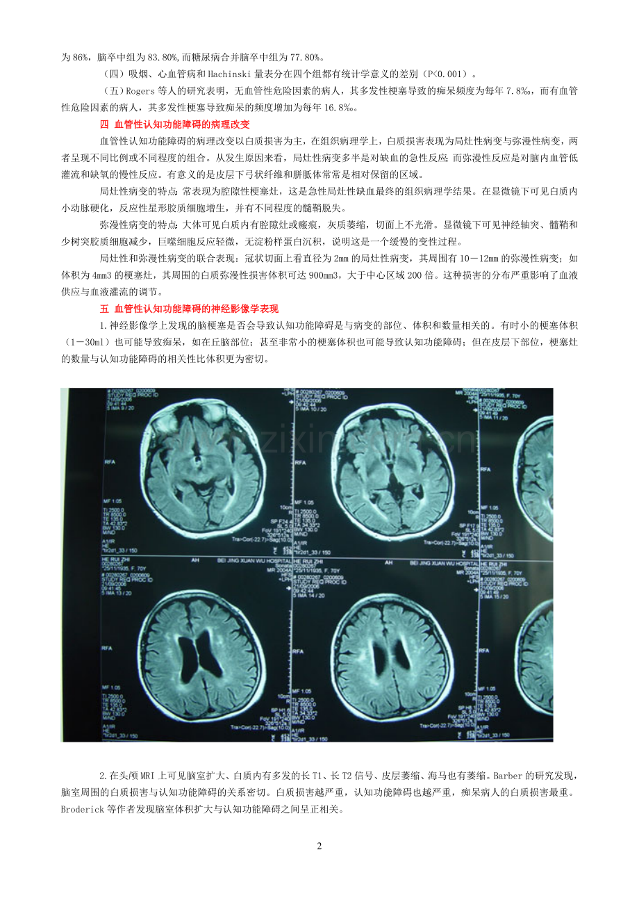 血管性认知功能障碍的诊断与治疗.doc_第2页