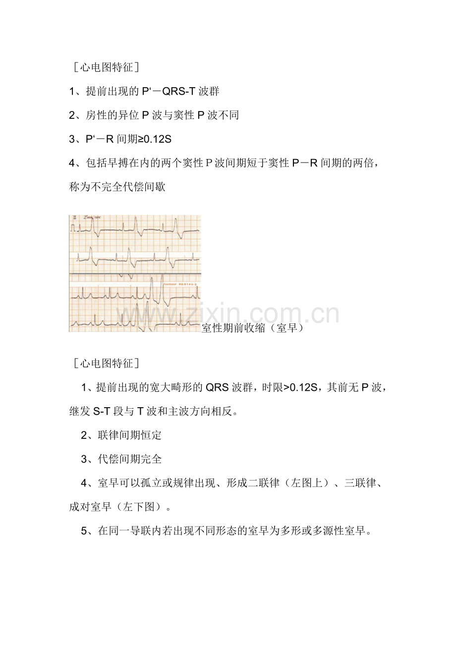正常心电图.doc_第2页