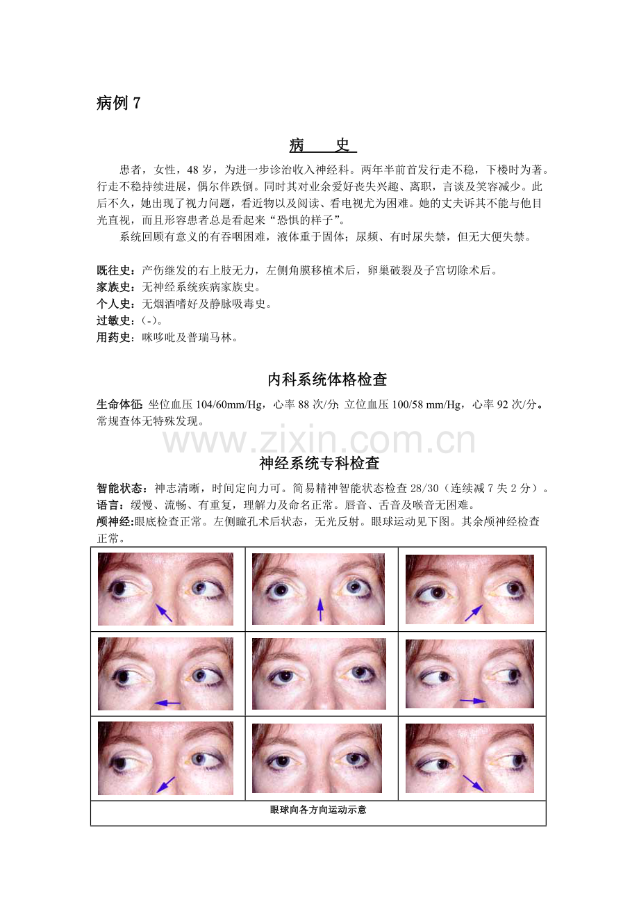 神经科疑难病例——进行性核上性眼肌麻痹.docx_第1页