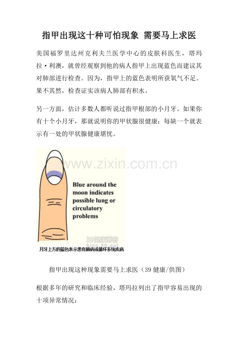 指甲出现这十种可怕现象 需要马上求医.doc_第1页