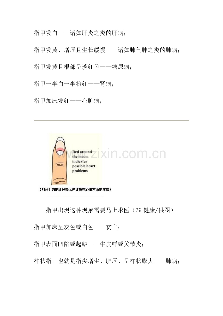 指甲出现这十种可怕现象 需要马上求医.doc_第2页