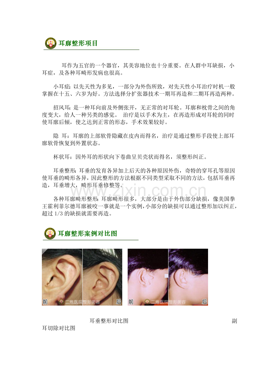 耳廓整形手术.doc_第2页