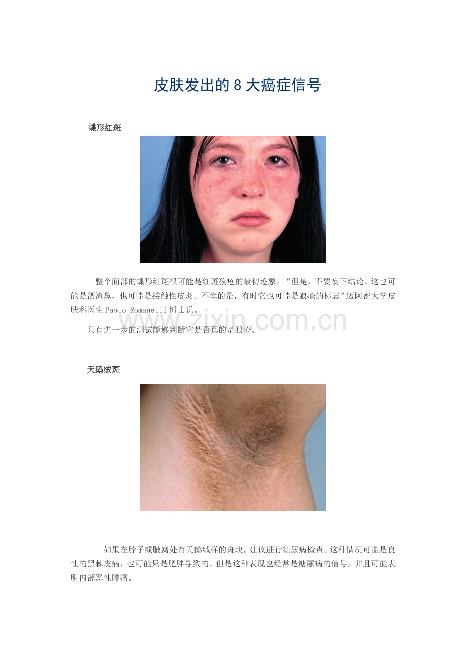 皮肤发出的8大癌症信号.doc_第1页