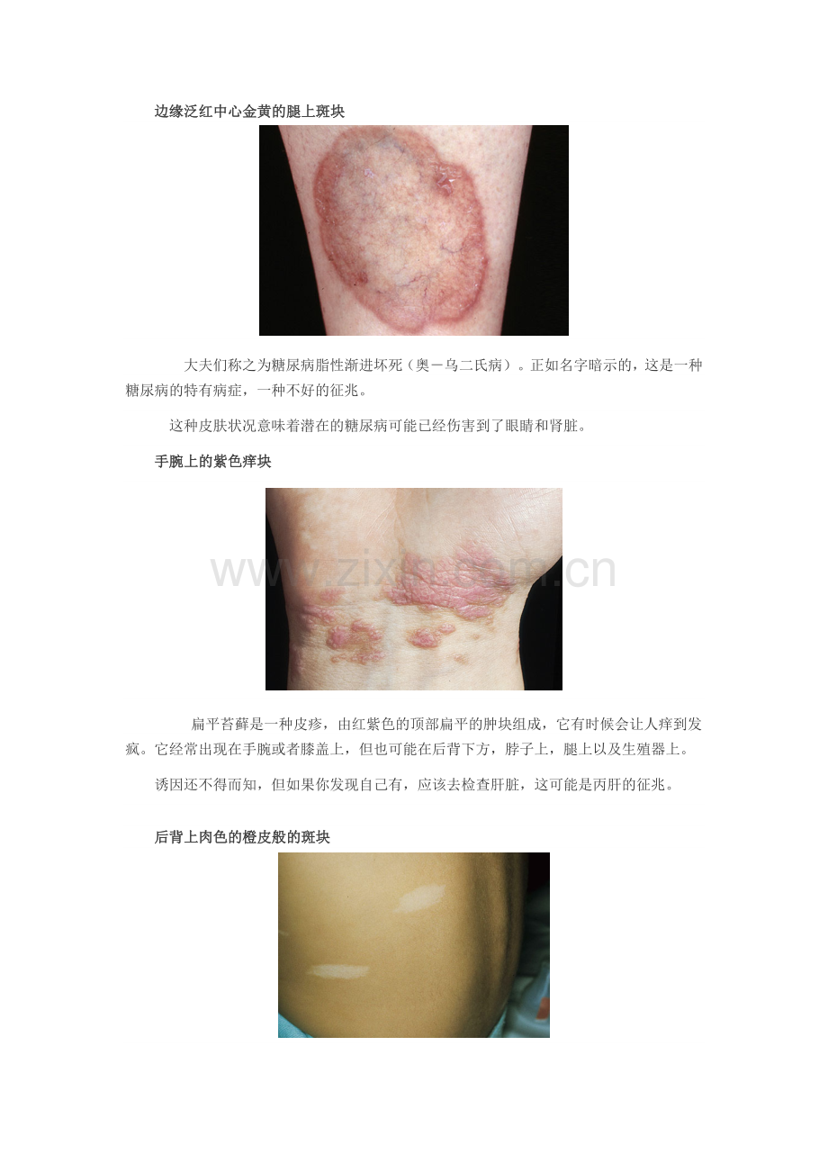 皮肤发出的8大癌症信号.doc_第2页