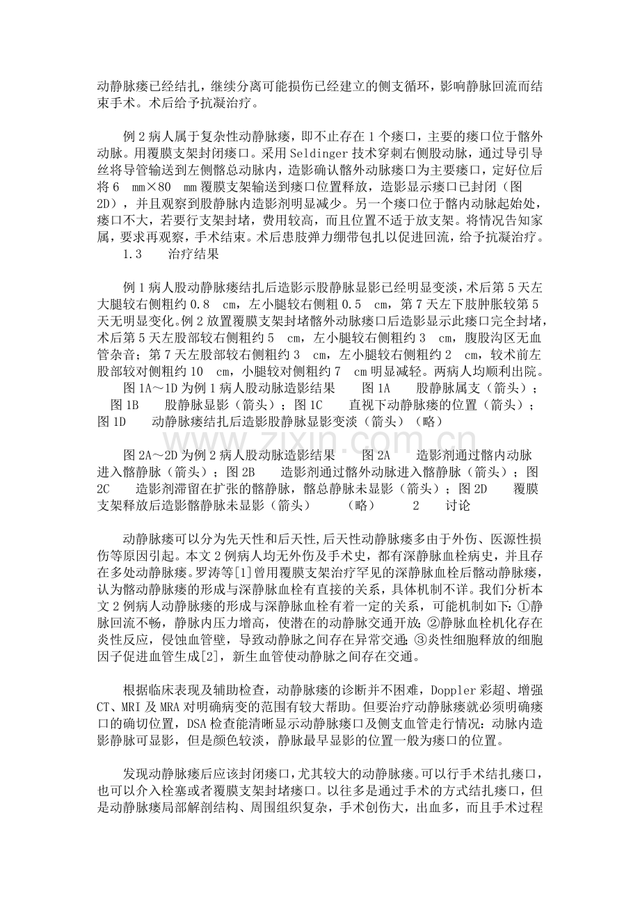 动静脉瘘.doc_第2页