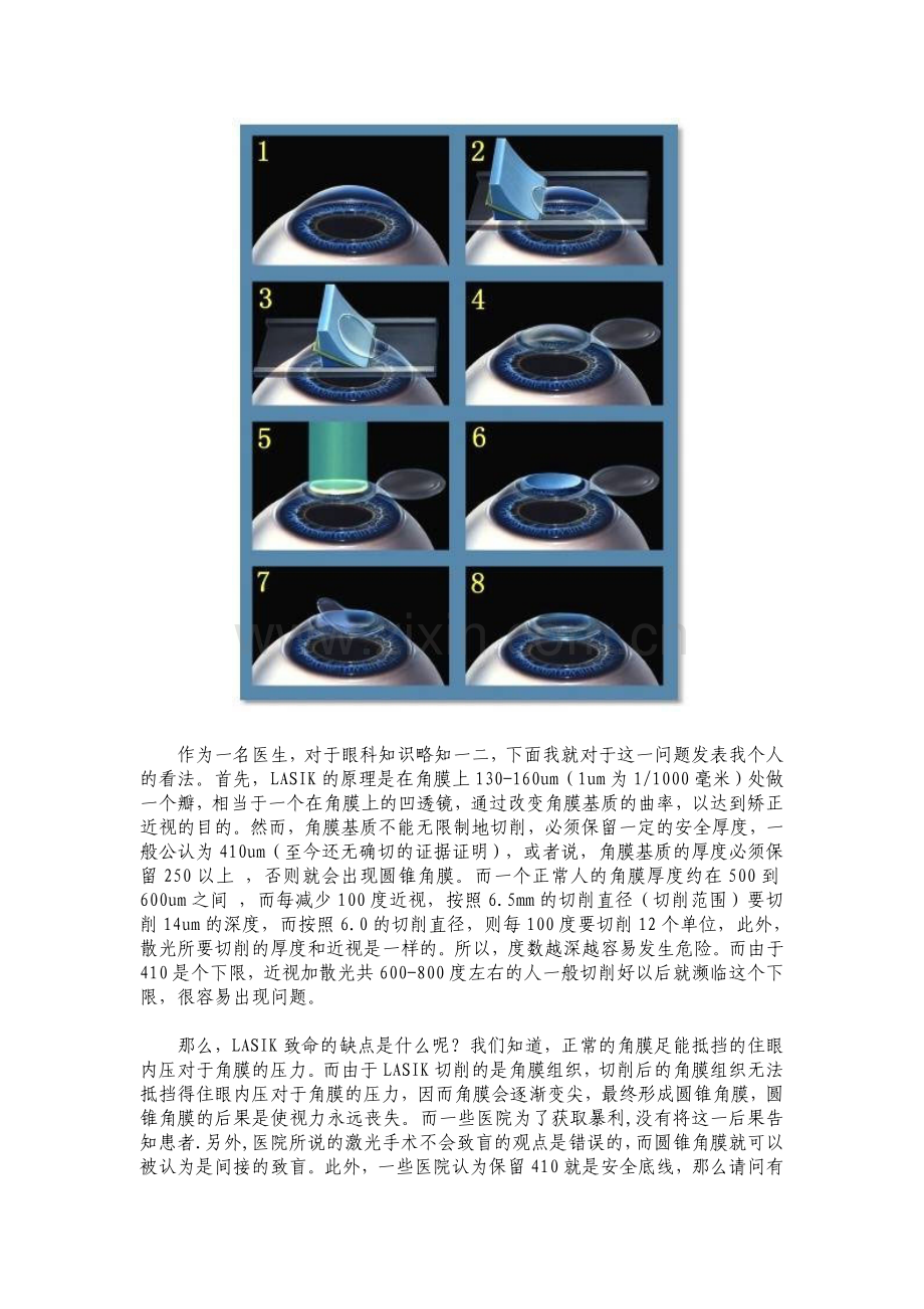 近视激光手术的利弊.doc_第2页