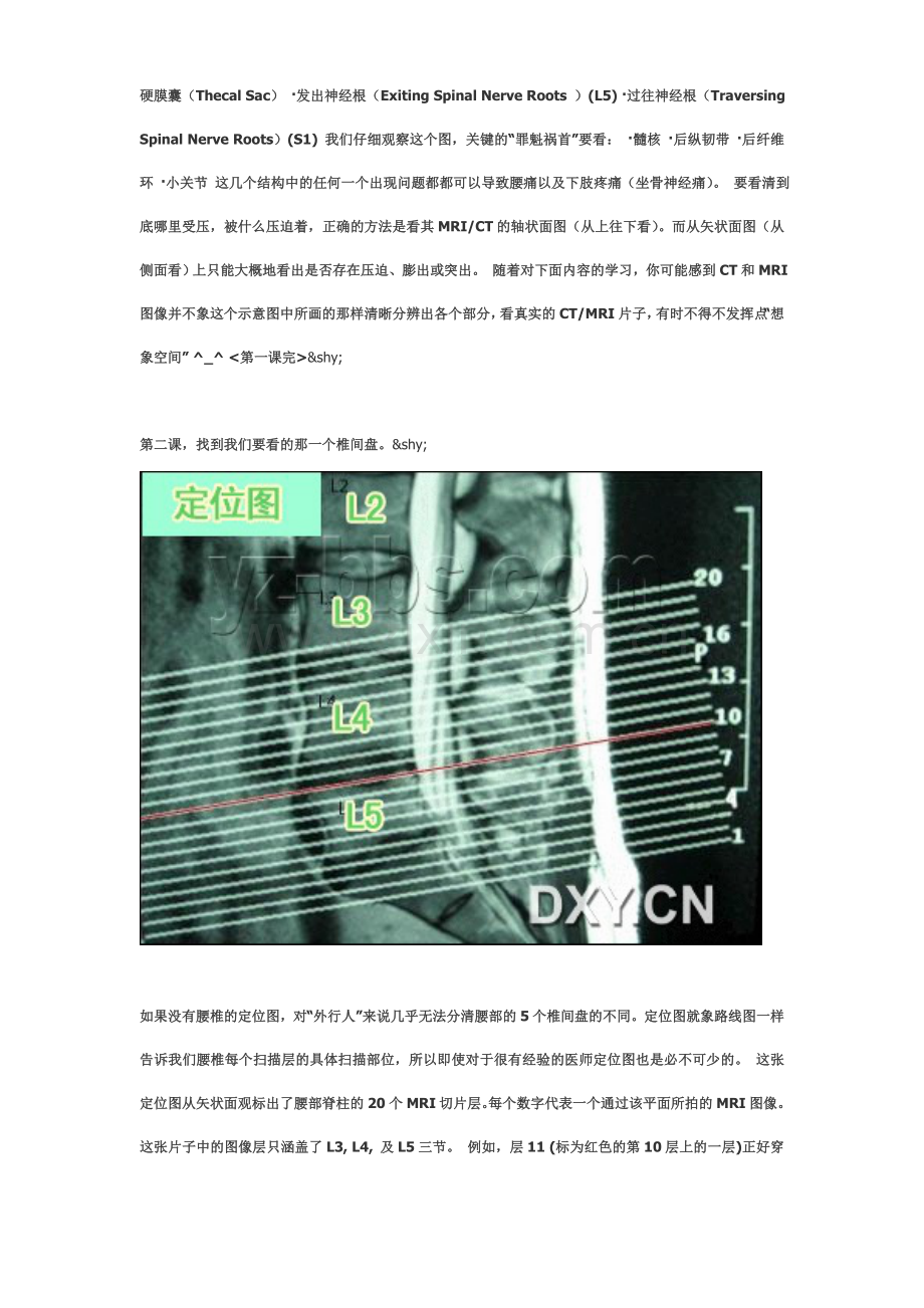 腰椎CT和MRI教程.doc_第2页