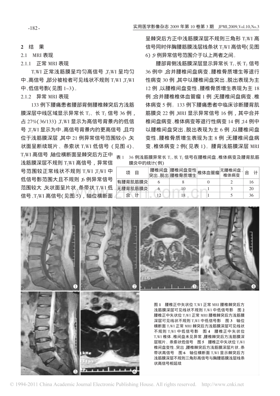 下腰痛患者腰背浅筋膜水肿的MRI诊断.pdf_第2页