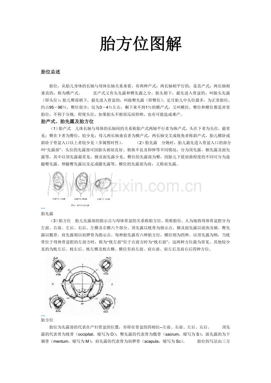 胎方位模型详细图解(2012经典版).doc_第1页