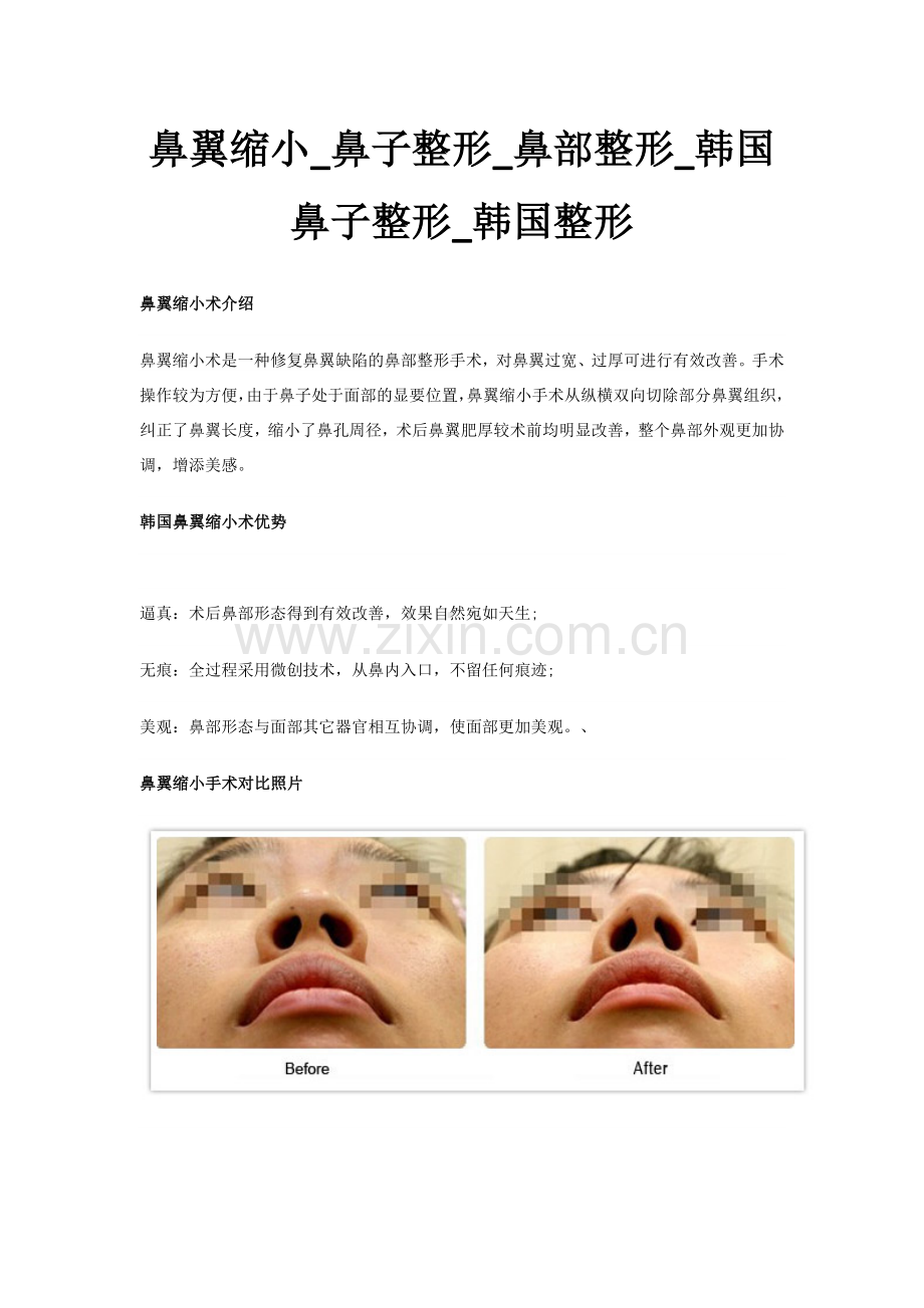 鼻翼缩小_鼻子整形_鼻部整形_韩国鼻子整形.docx_第1页