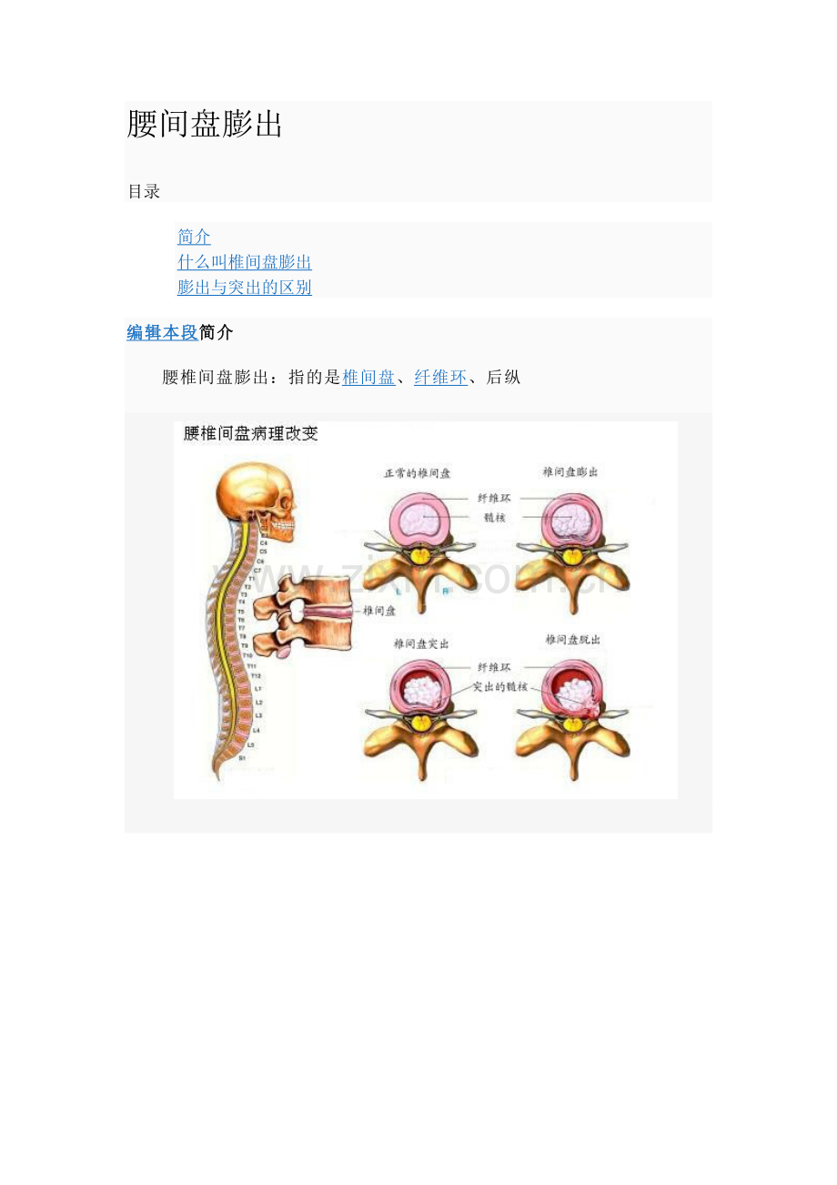 腰间盘病变.doc_第1页