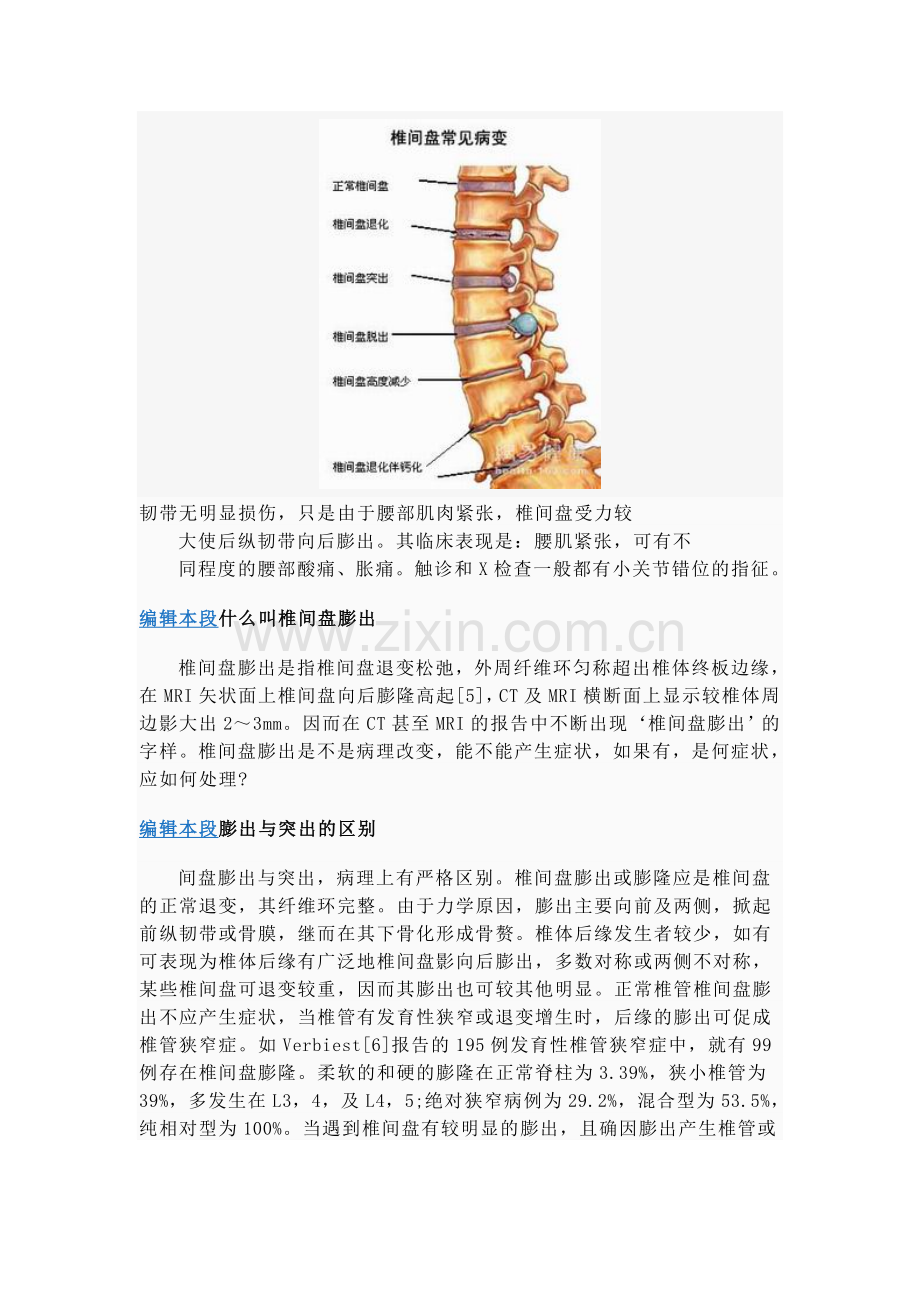 腰间盘病变.doc_第2页