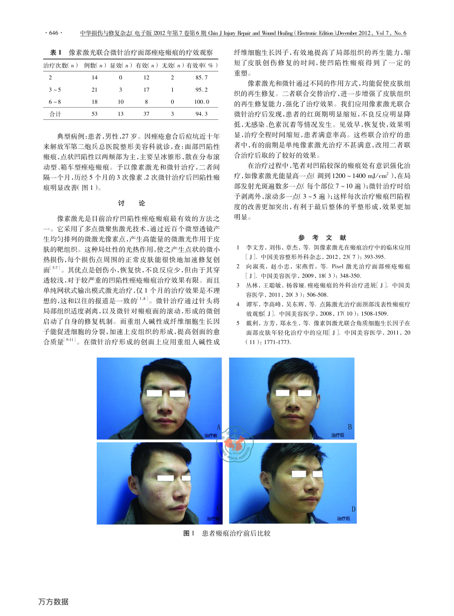 合微针治疗面部痤疮瘢痕的疗效观察.pdf_第2页