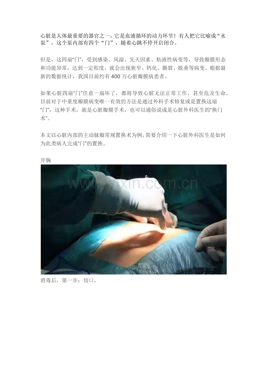 心脏瓣膜病置换手术过程图解及患者关心问题解析.docx_第1页