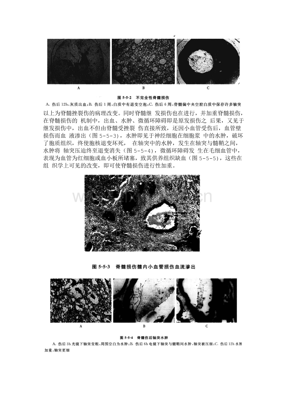 脊髓损伤的病理改变.doc_第2页