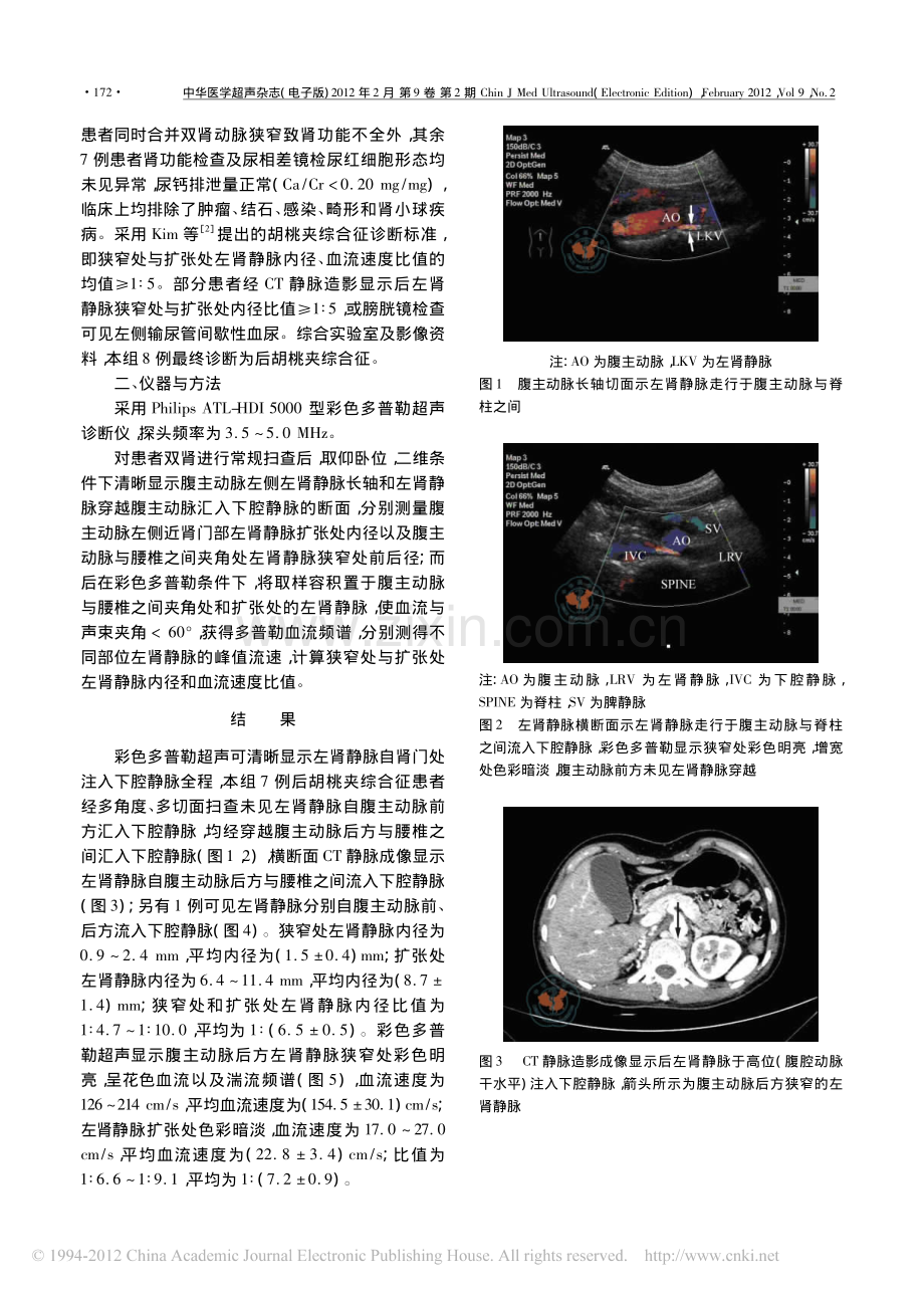 后胡桃夹综合征患者彩色多普勒超声表现.pdf_第2页