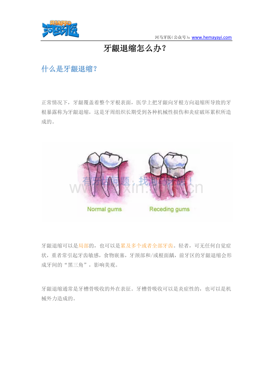 牙龈萎缩怎么办.docx_第1页