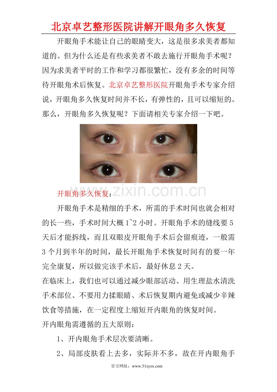 开眼角多久恢复？.doc_第1页