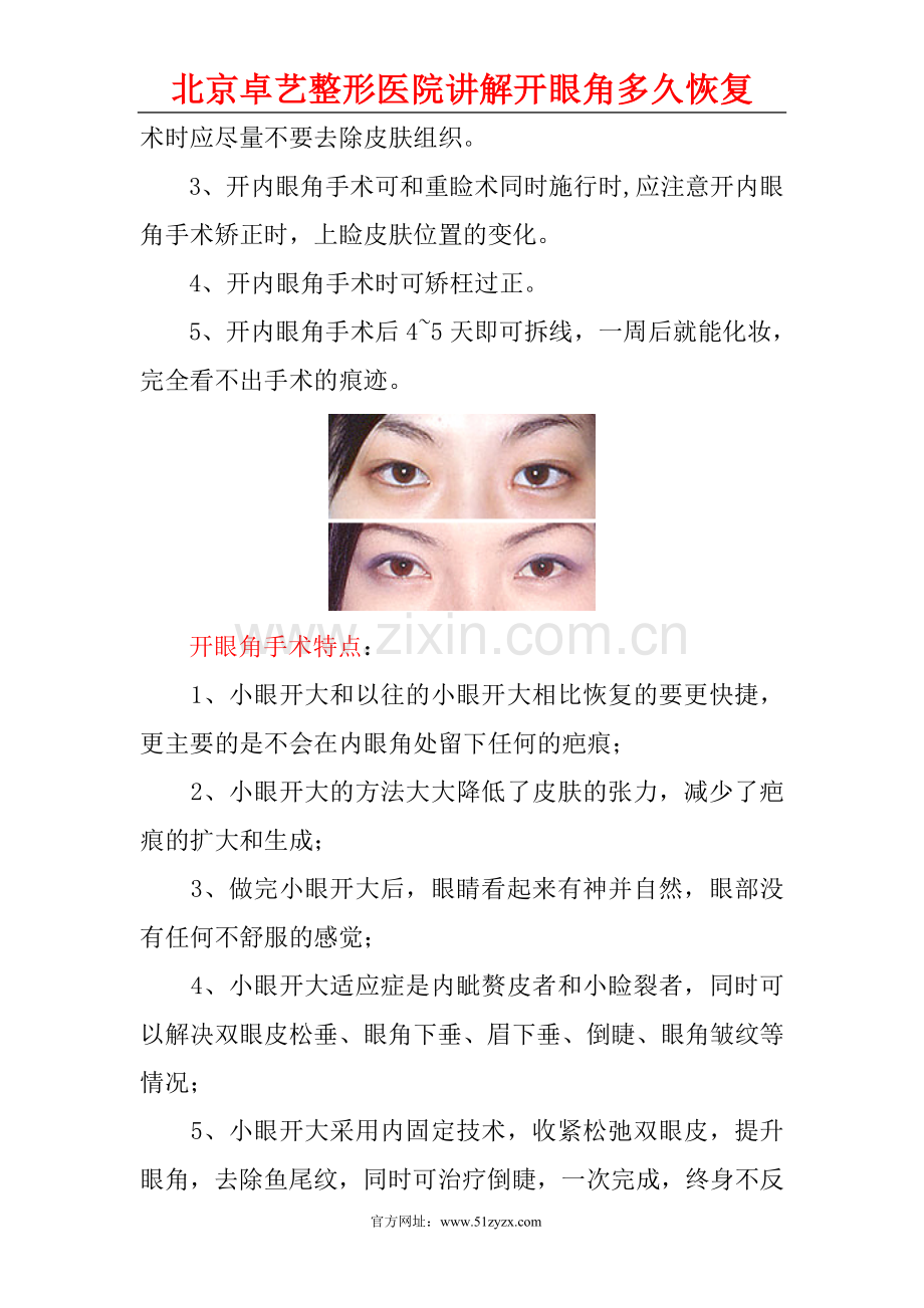开眼角多久恢复？.doc_第2页