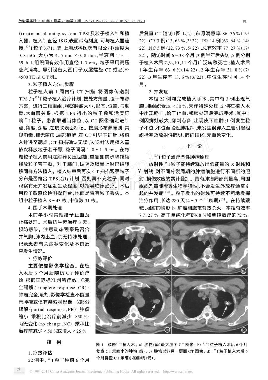 CT导引下_125_I粒子植入治疗周围型非小细胞肺癌.pdf_第2页