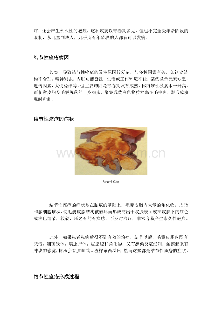 结节性痤疮.doc_第2页