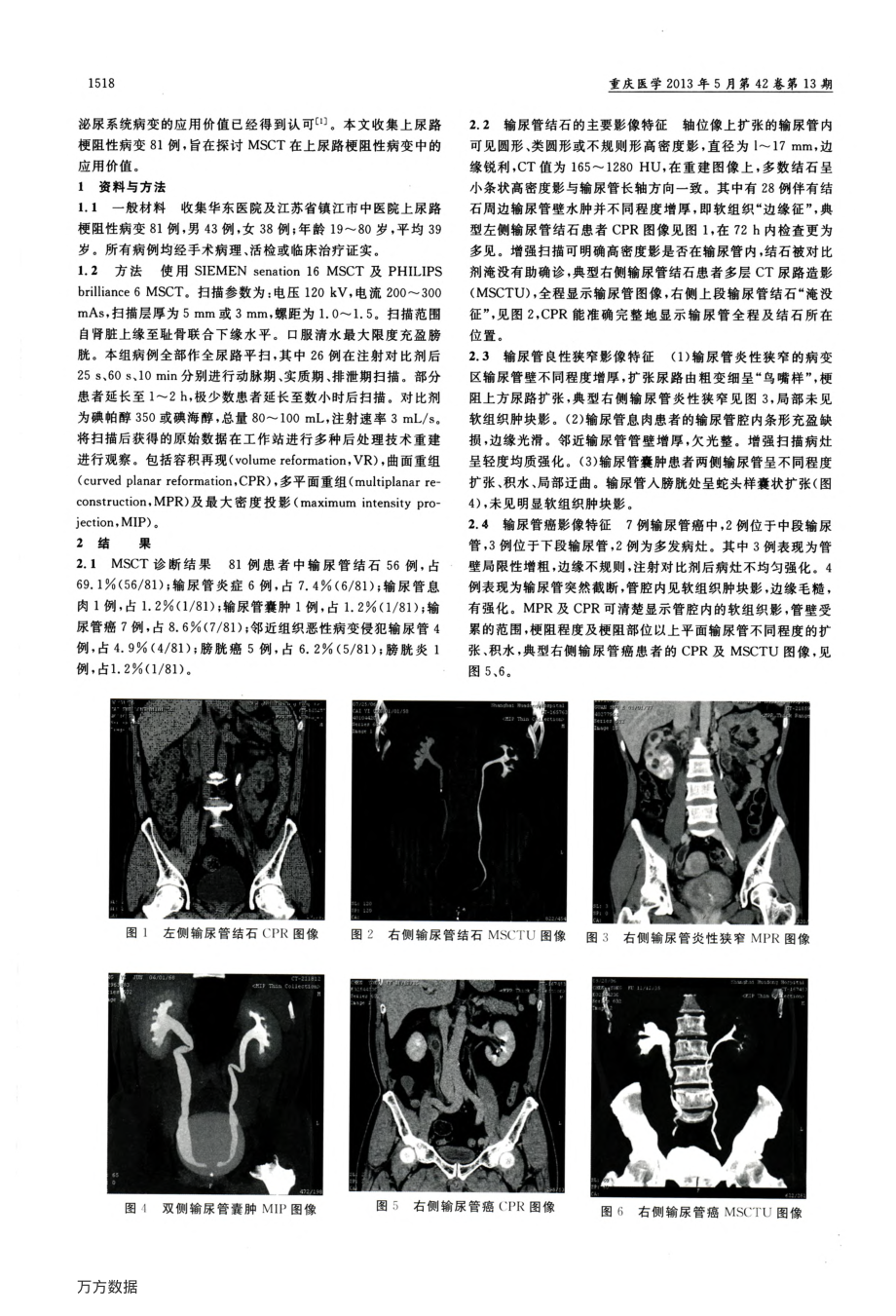 多层螺旋CT在上尿路梗阻性病变中的应用价值.pdf_第2页