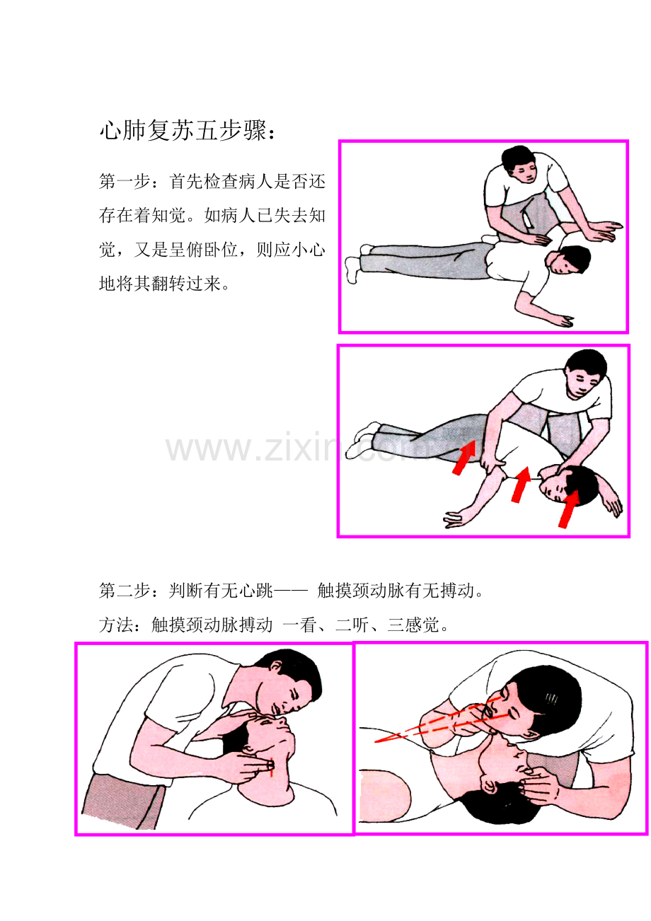 心肺复苏五步骤.doc_第1页
