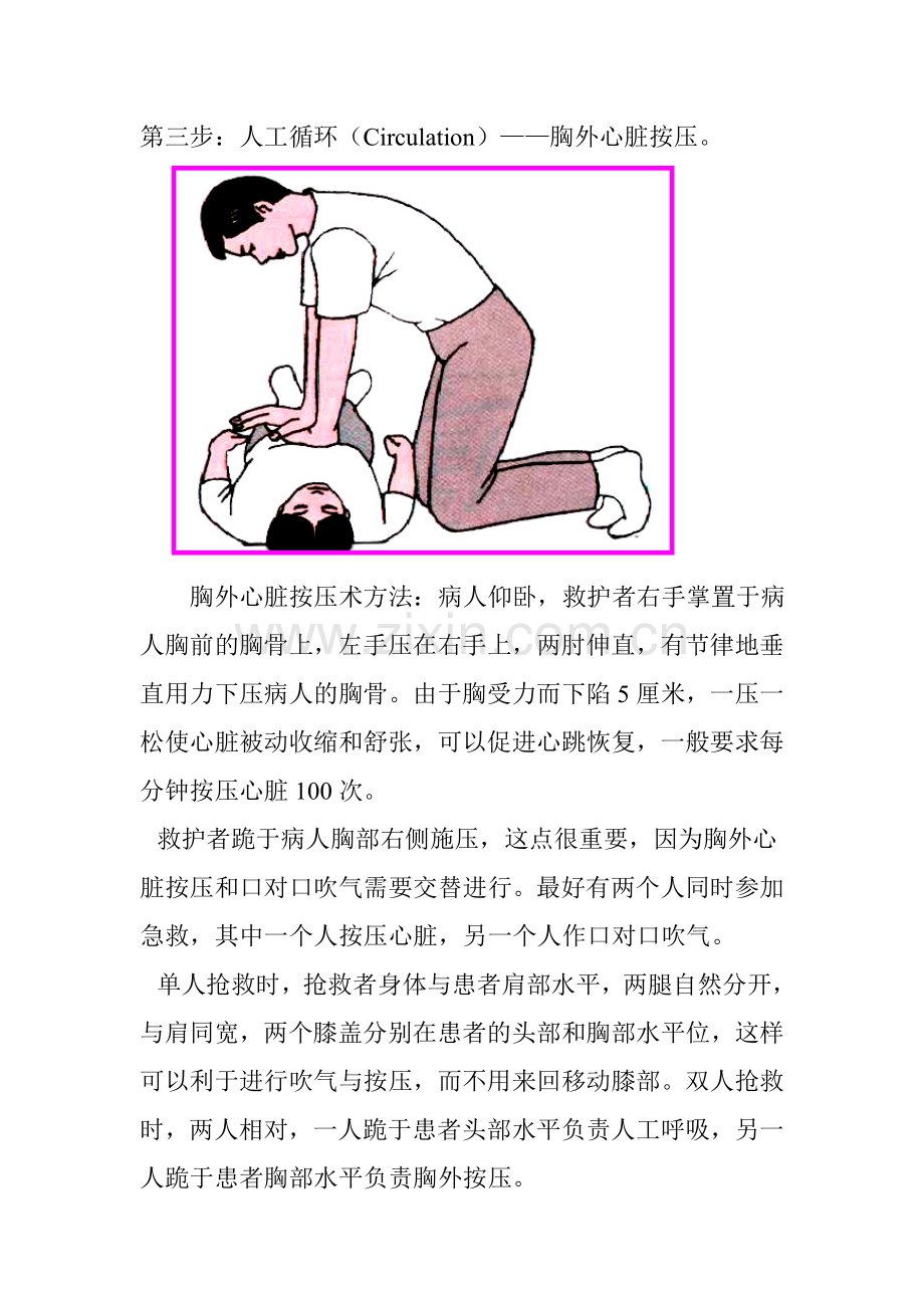 心肺复苏五步骤.doc_第2页
