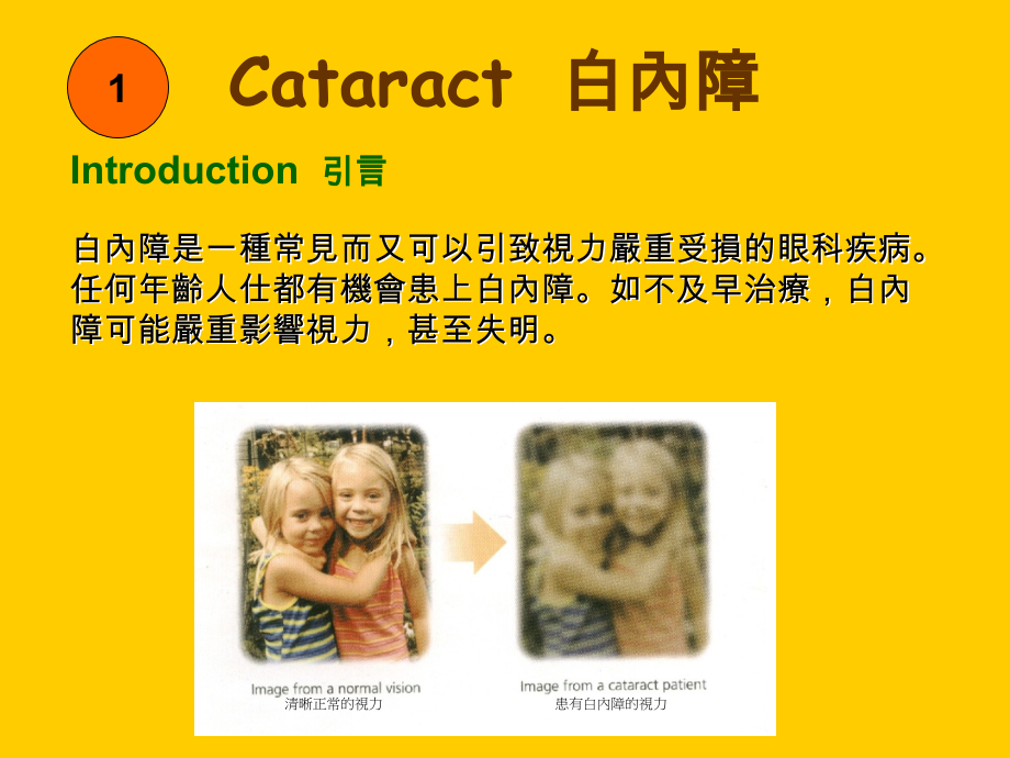 眼睛的保健.pps_第2页