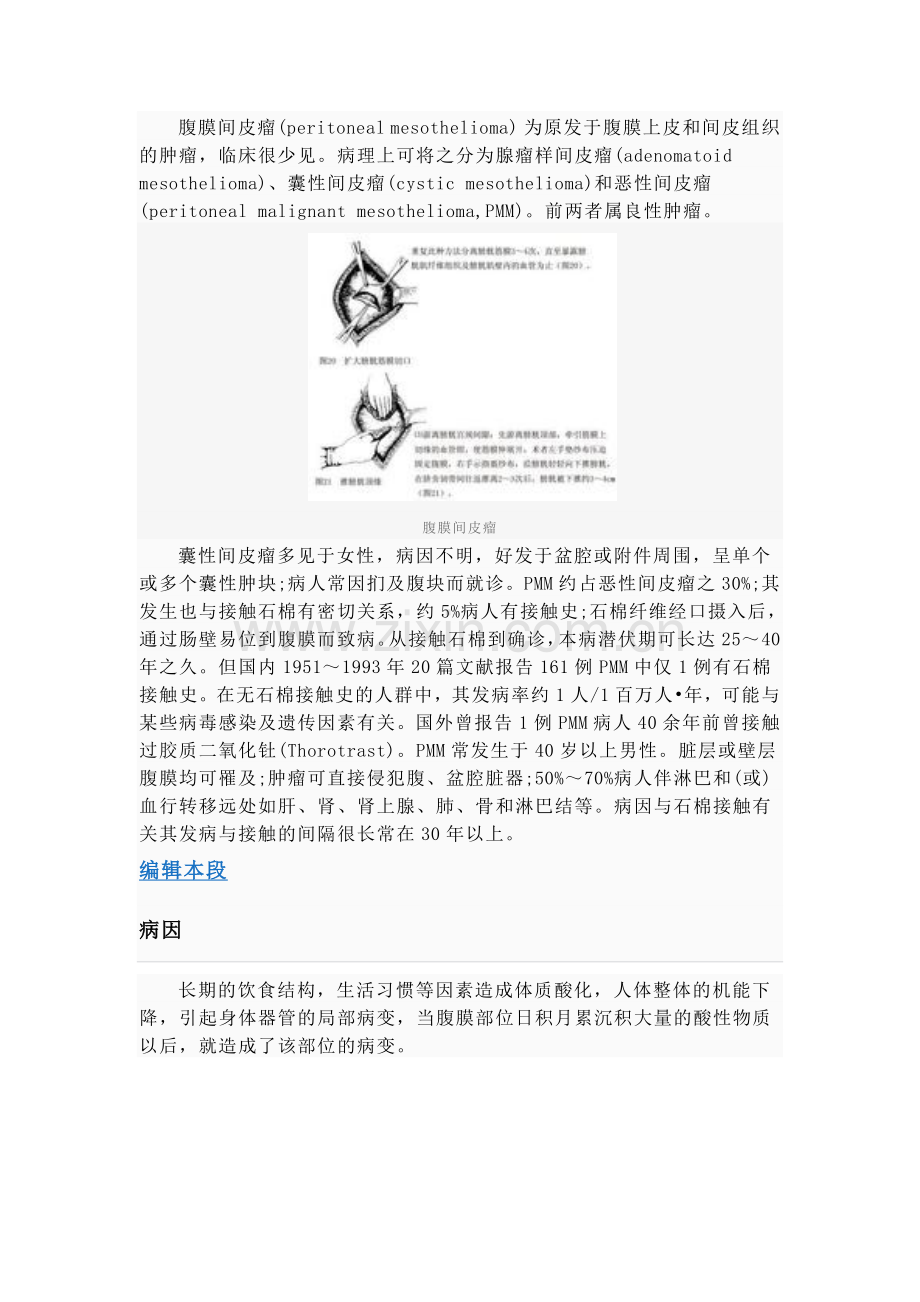 腹膜间皮瘤.doc_第2页