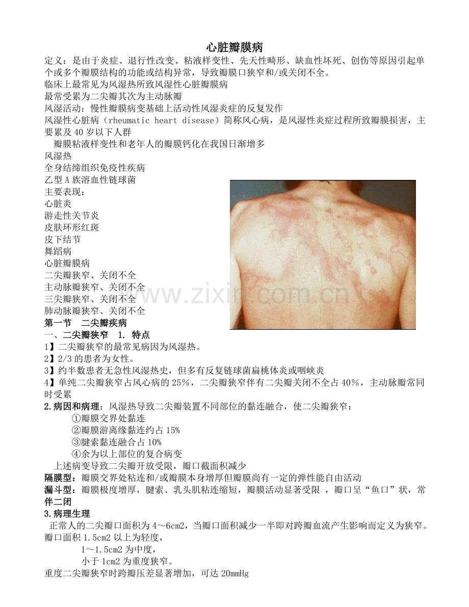 心脏瓣膜病.doc_第1页