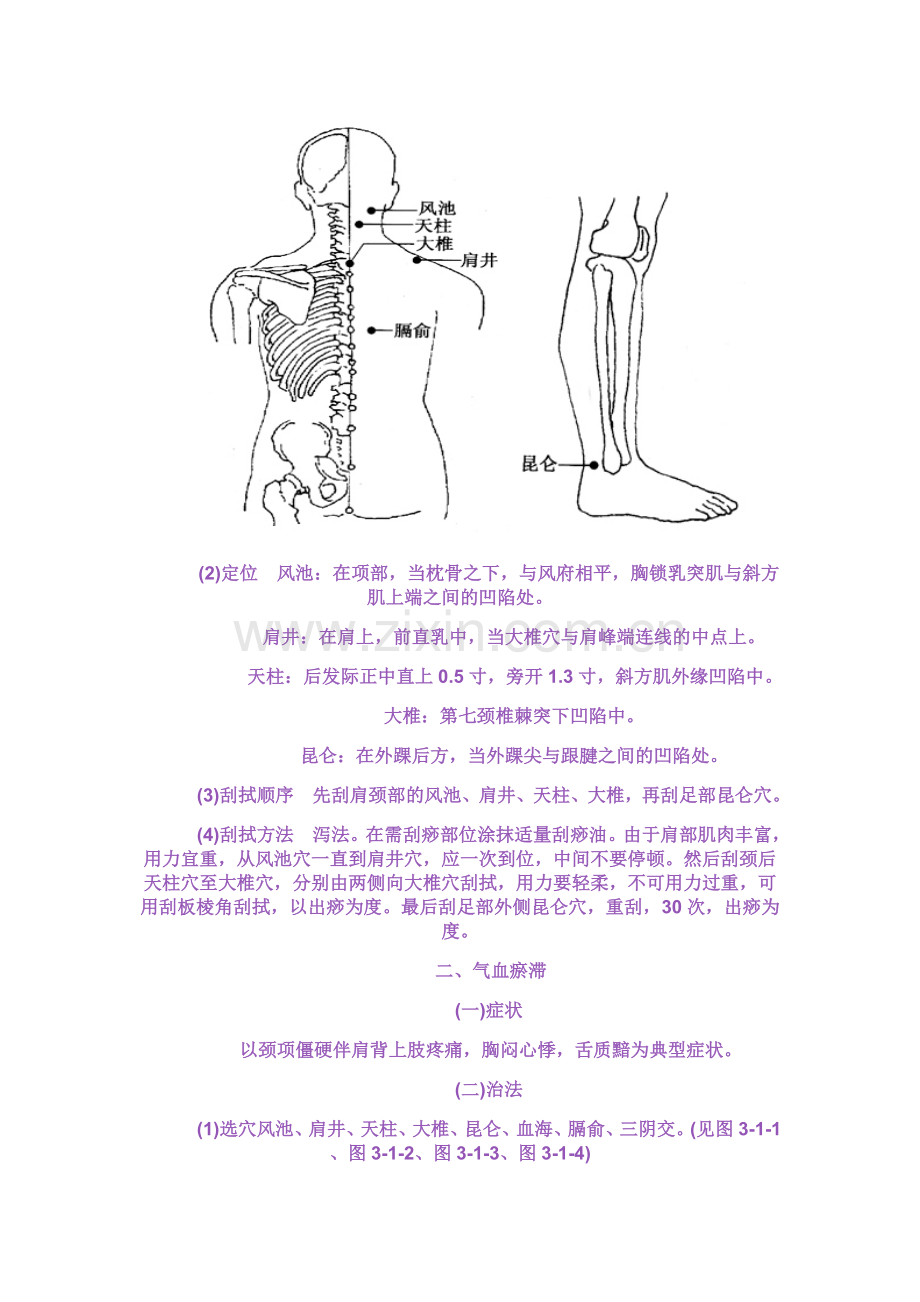 椎病的刮痧疗法.doc_第2页