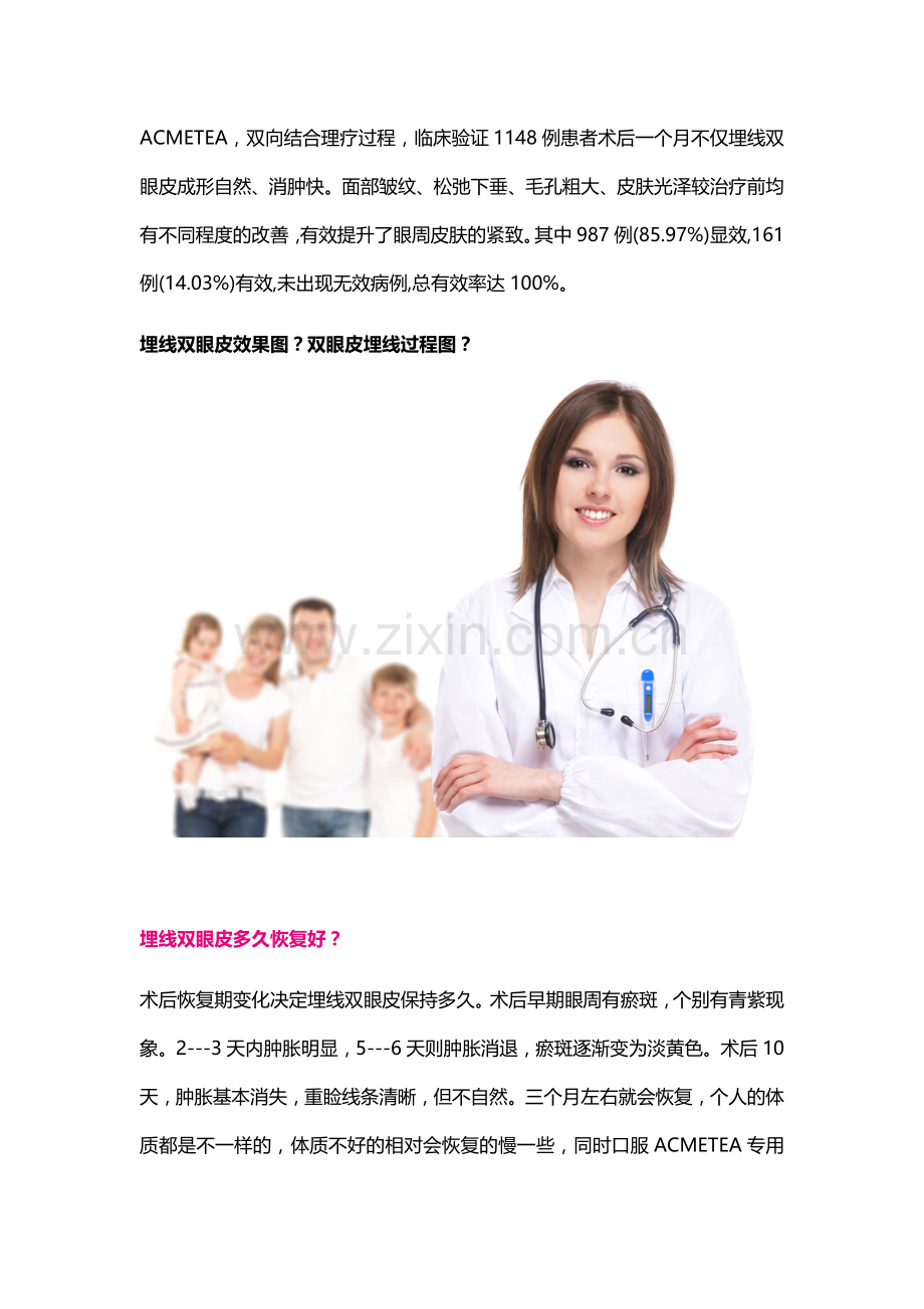 埋线双眼皮效果图？双眼皮埋线过程图？.docx_第2页