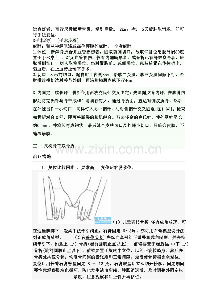 四肢骨折.doc_第2页