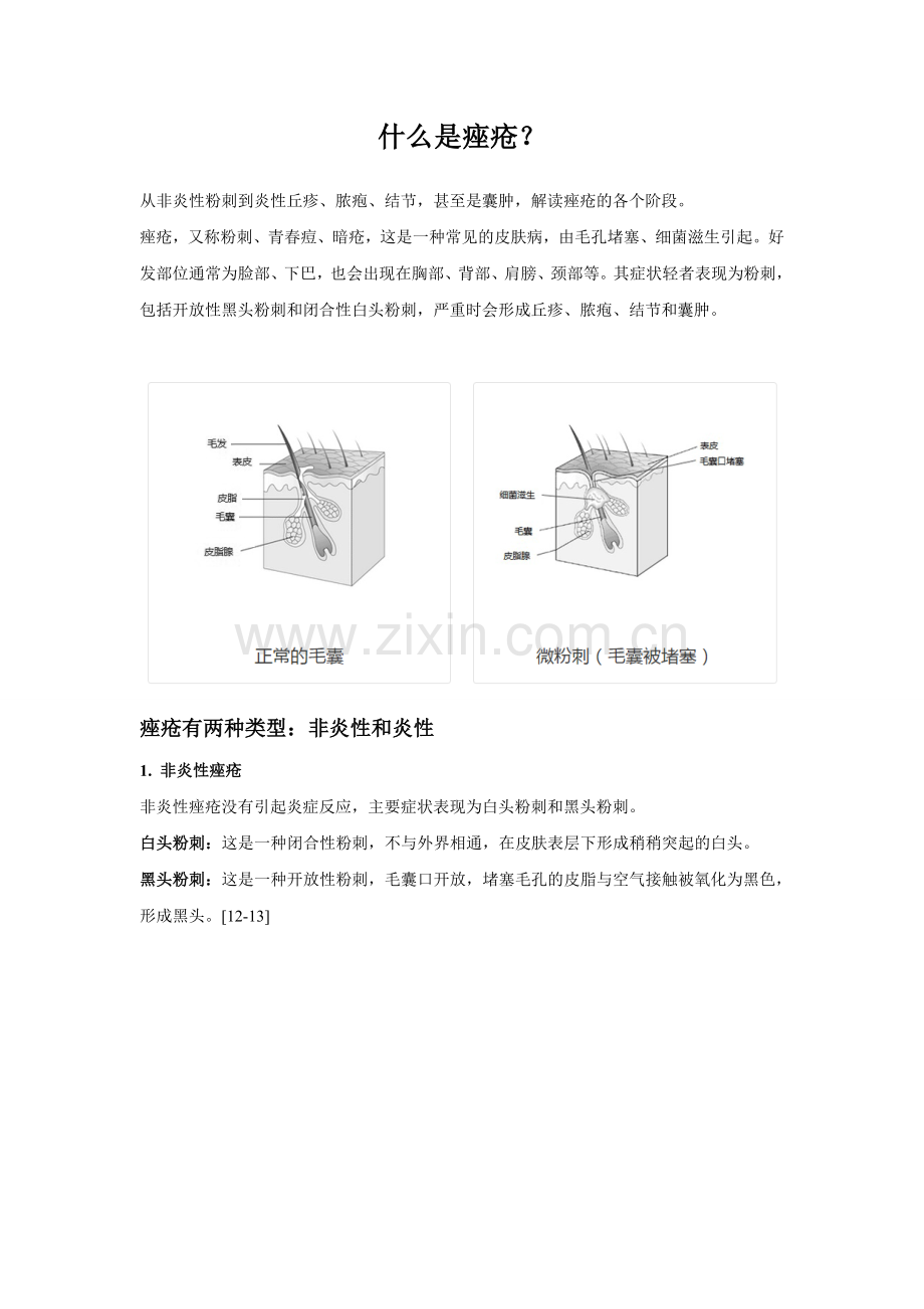 什么是痤疮.doc_第1页