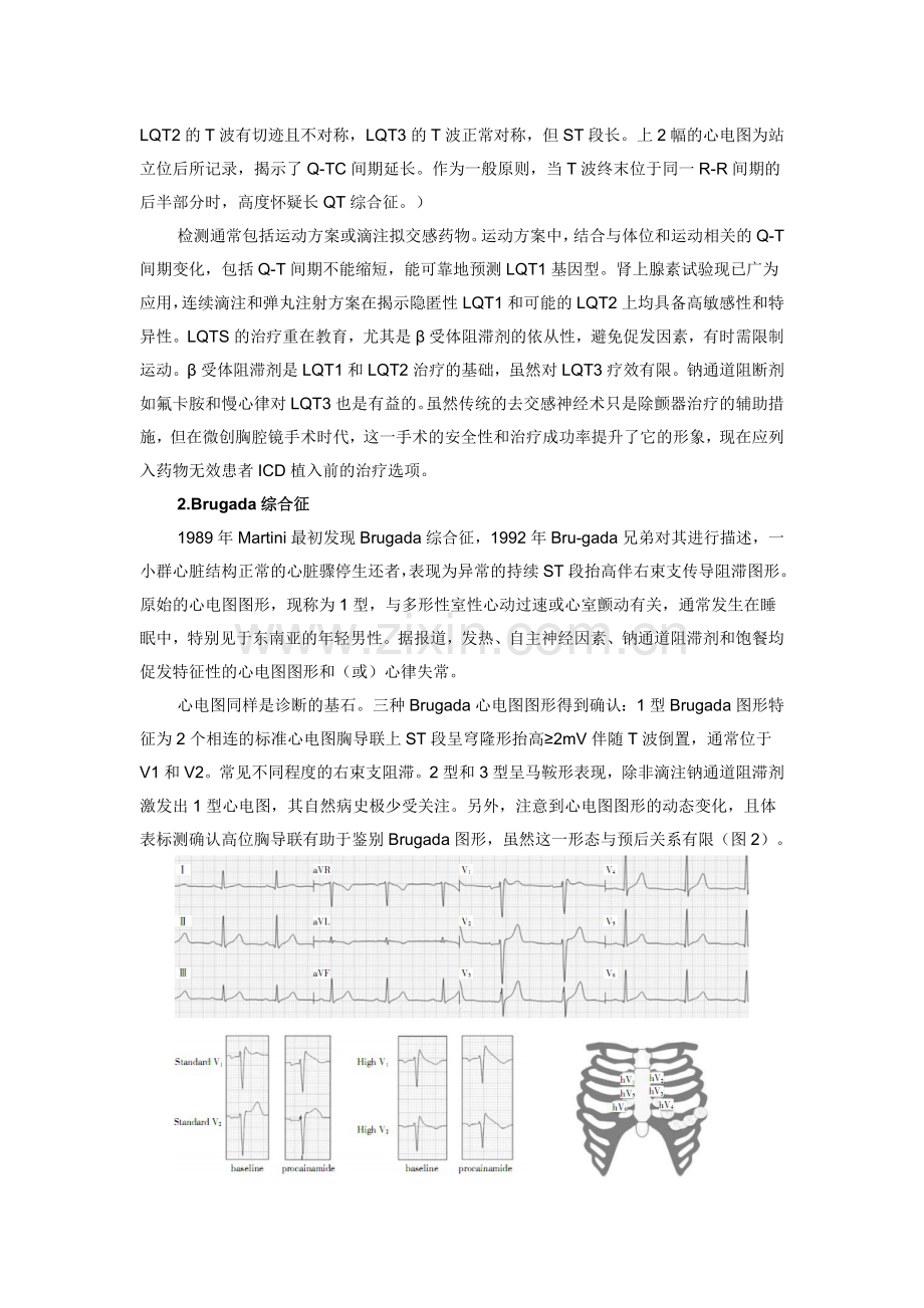 无明显心脏疾病的心脏骤停应考虑哪些情况？.doc_第2页
