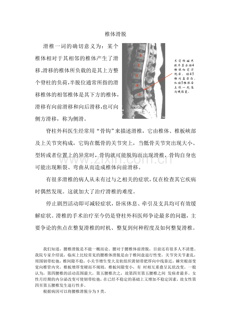 腰椎滑脱.doc_第1页
