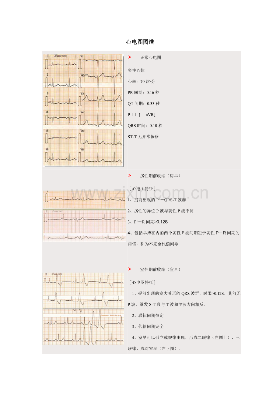 心电图图谱1.doc_第1页
