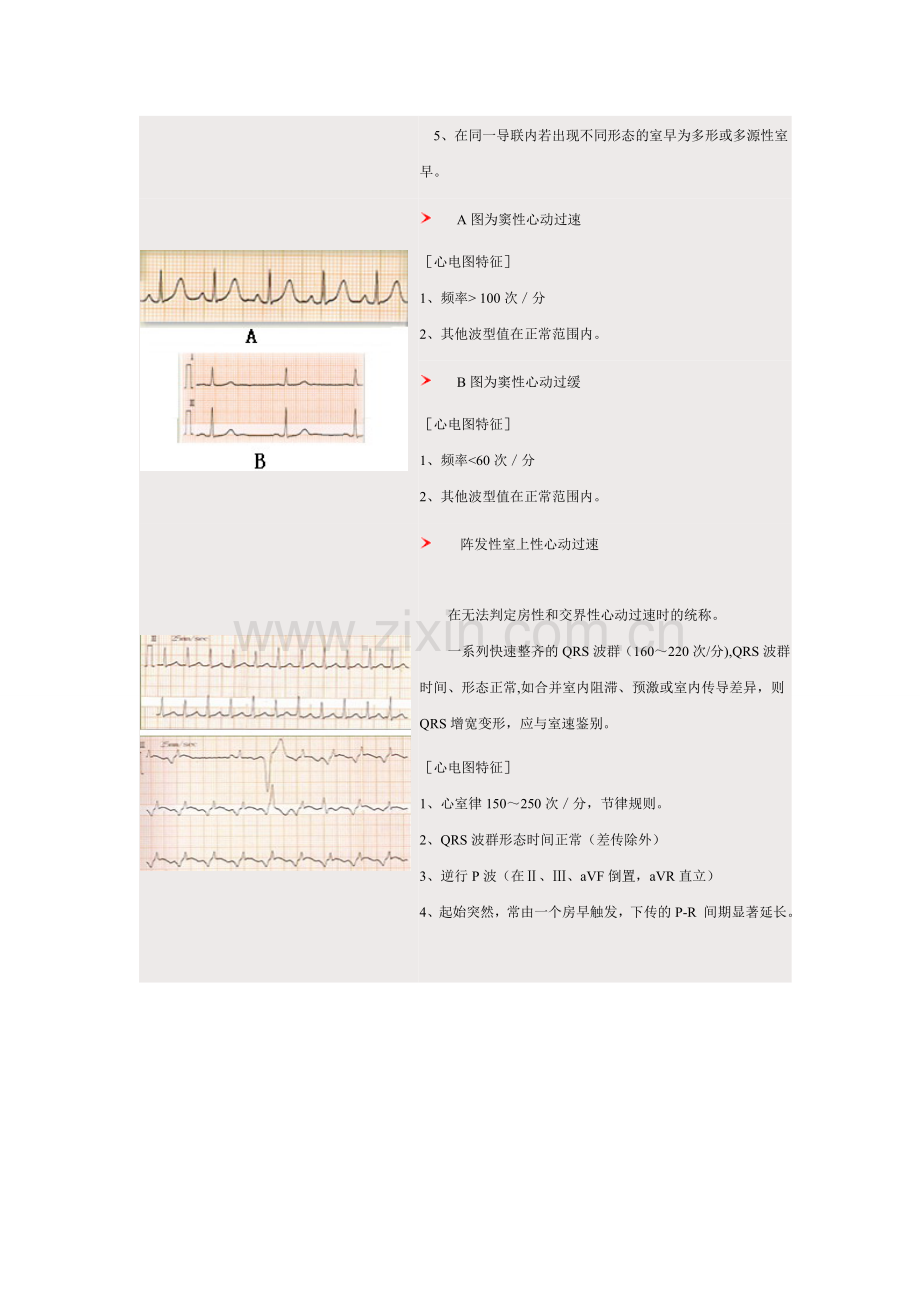 心电图图谱1.doc_第2页