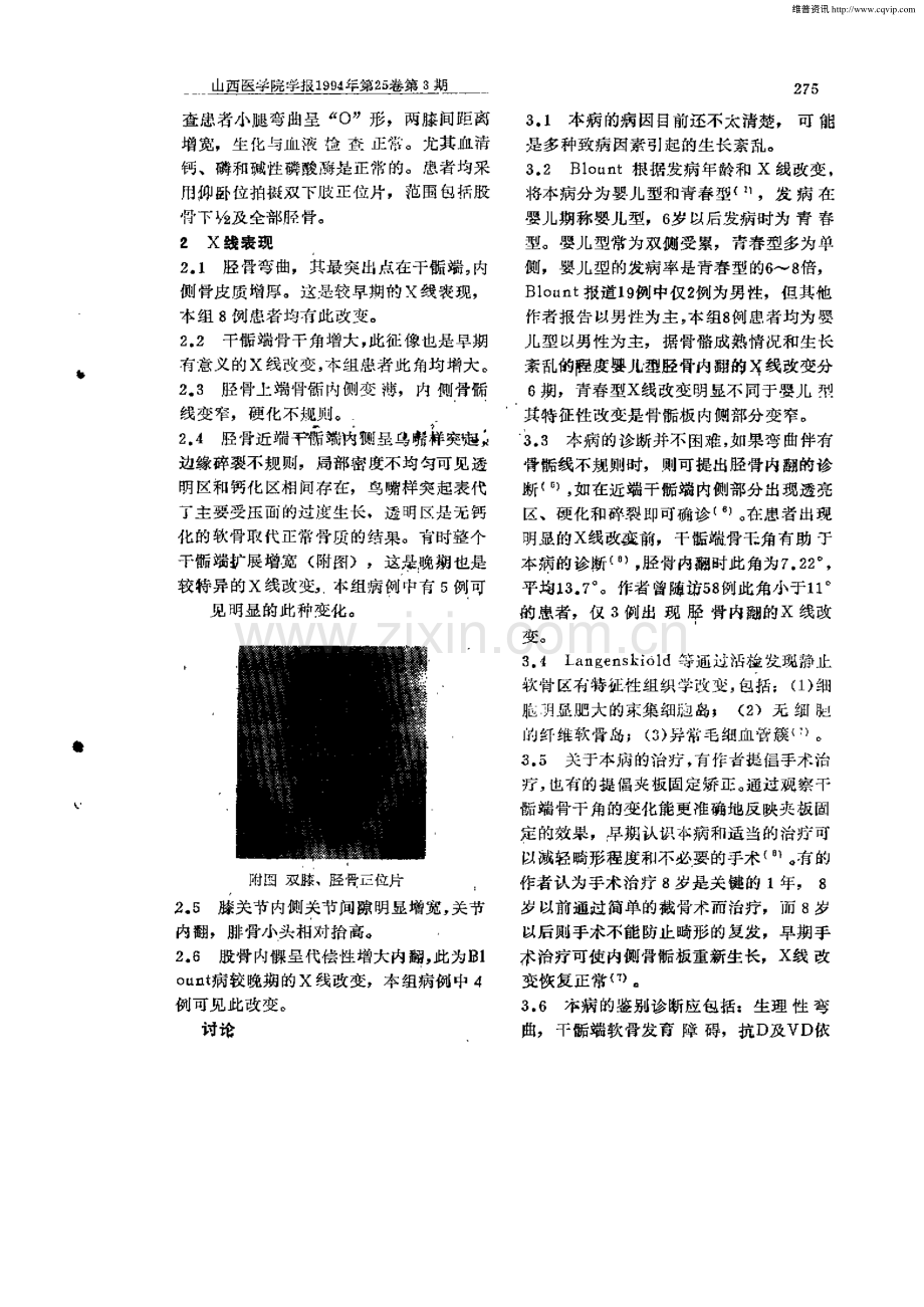 Blount病的X线表现.pdf_第2页