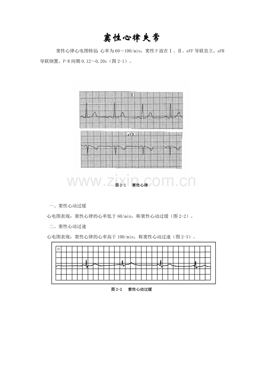 浅易心电图.doc_第1页