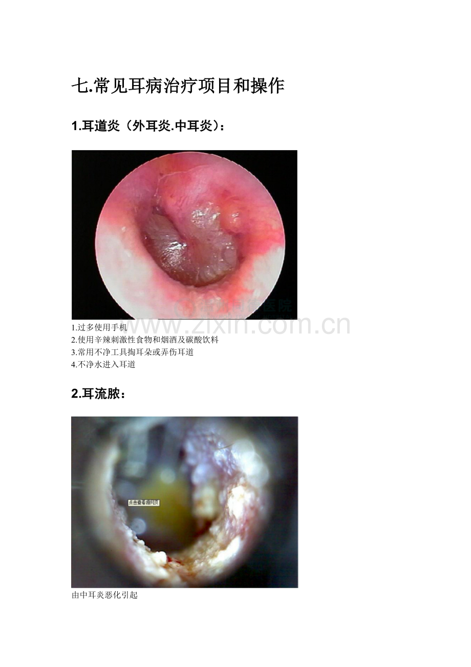 常见耳病治疗项目和操作.doc_第1页