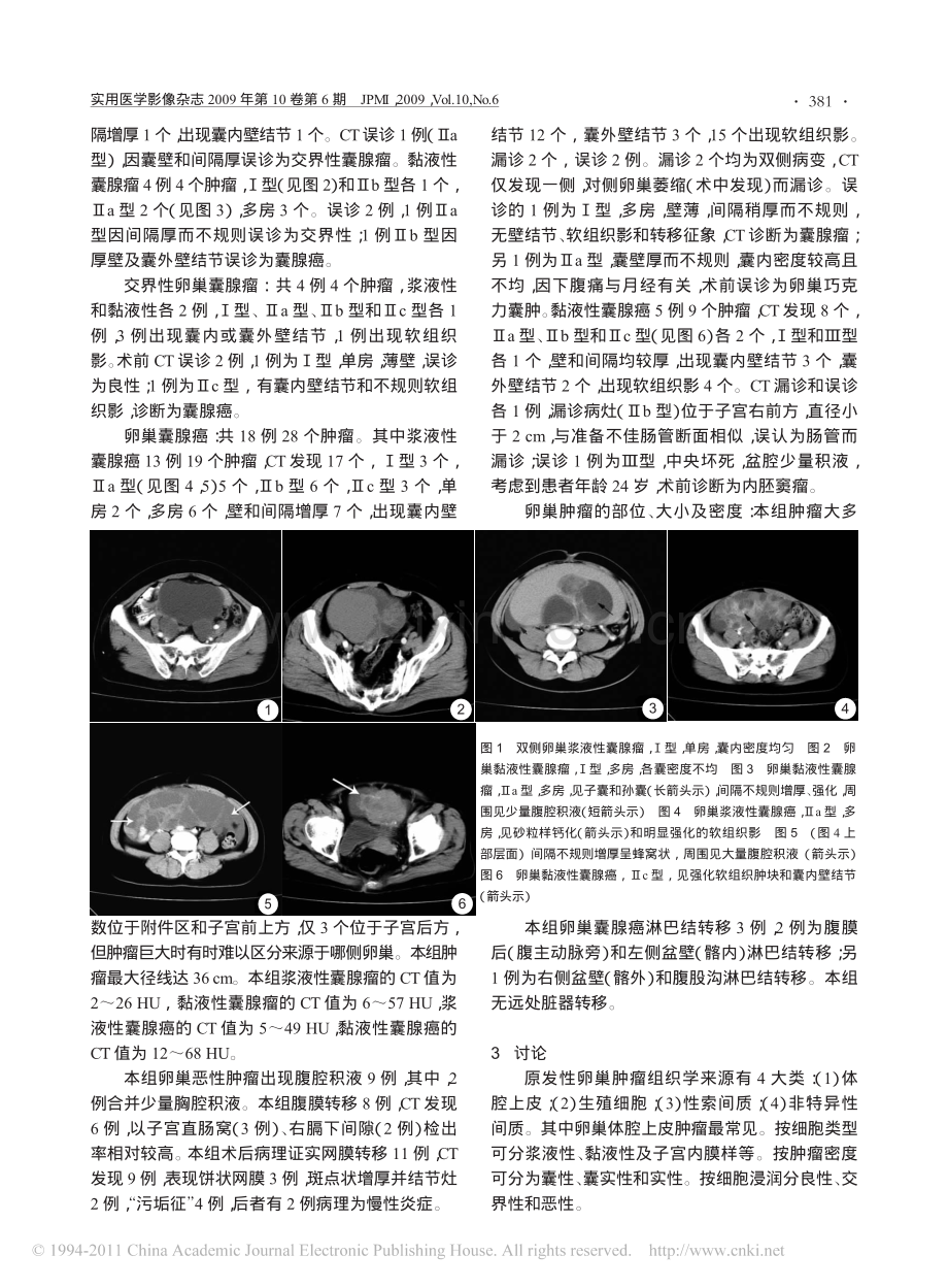 卵巢囊腺瘤与囊腺癌的CT诊断.pdf_第2页
