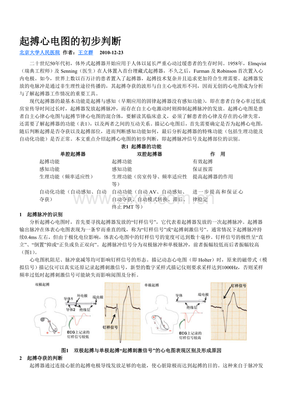 起搏心电图.doc_第1页