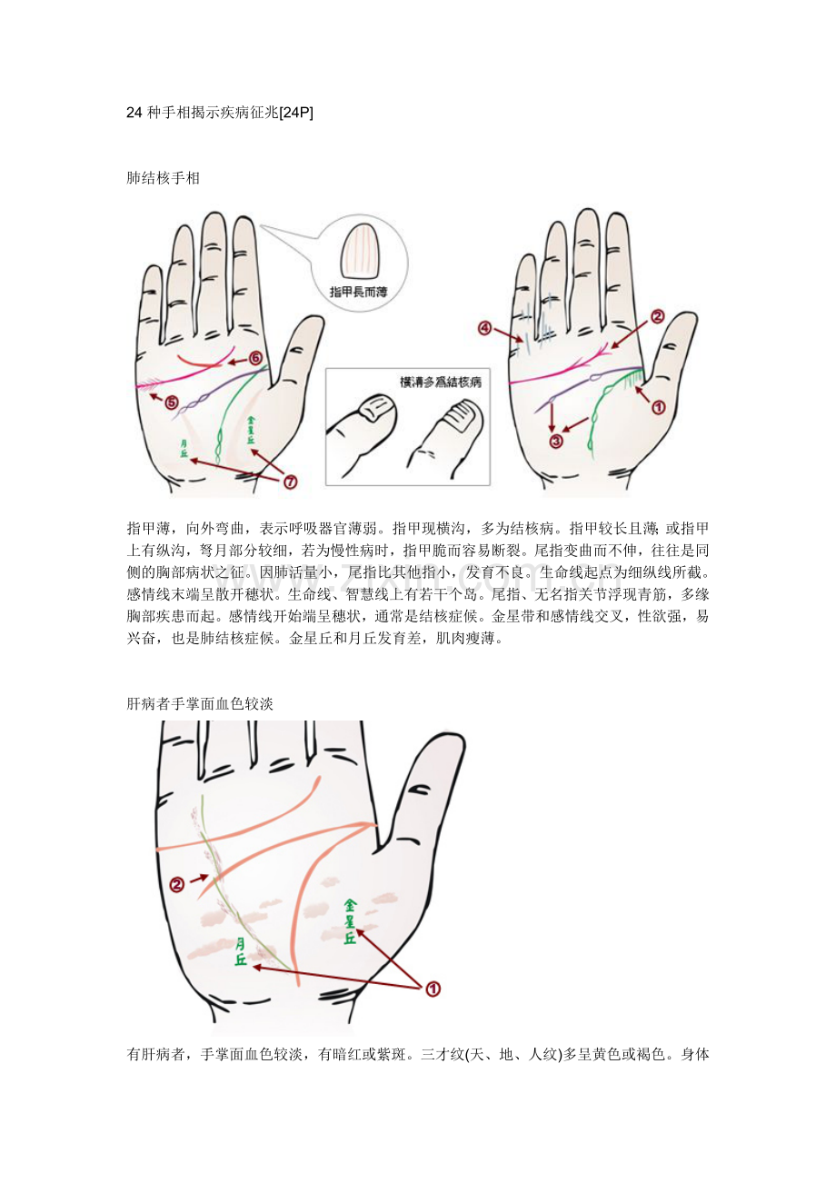 手相看病.doc_第1页