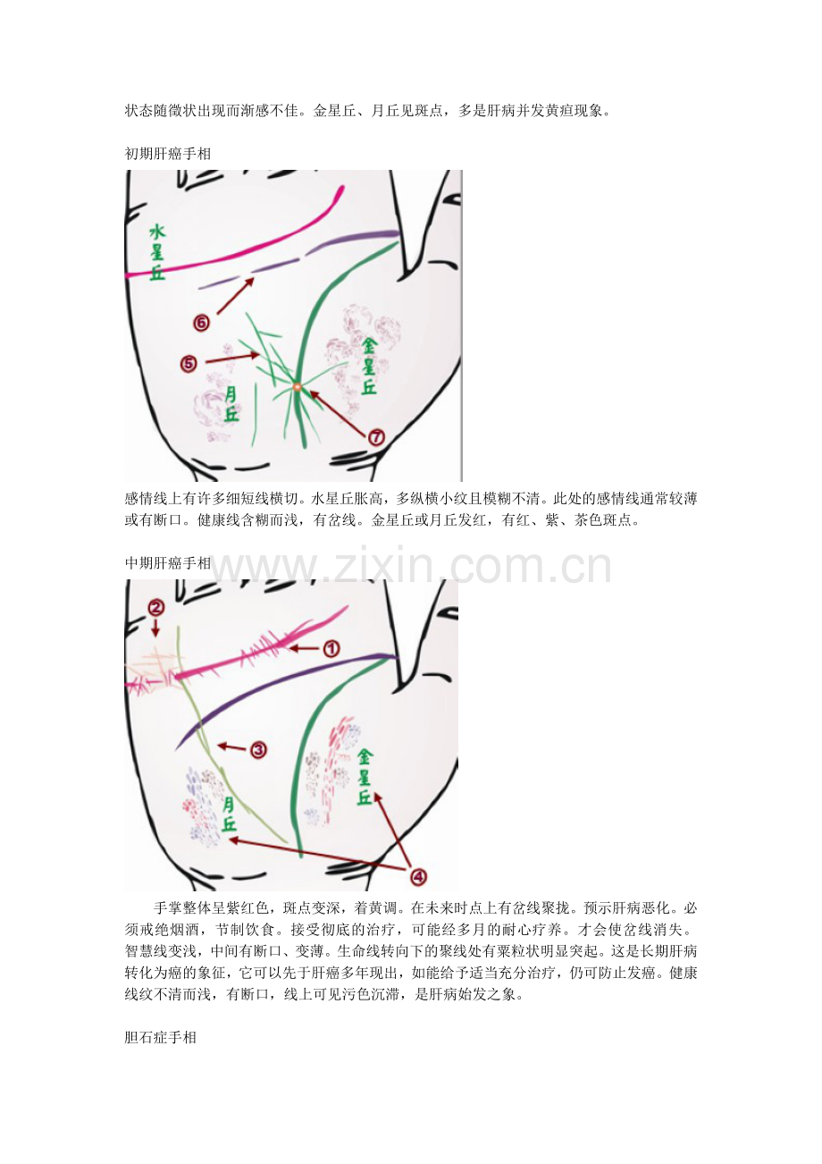 手相看病.doc_第2页