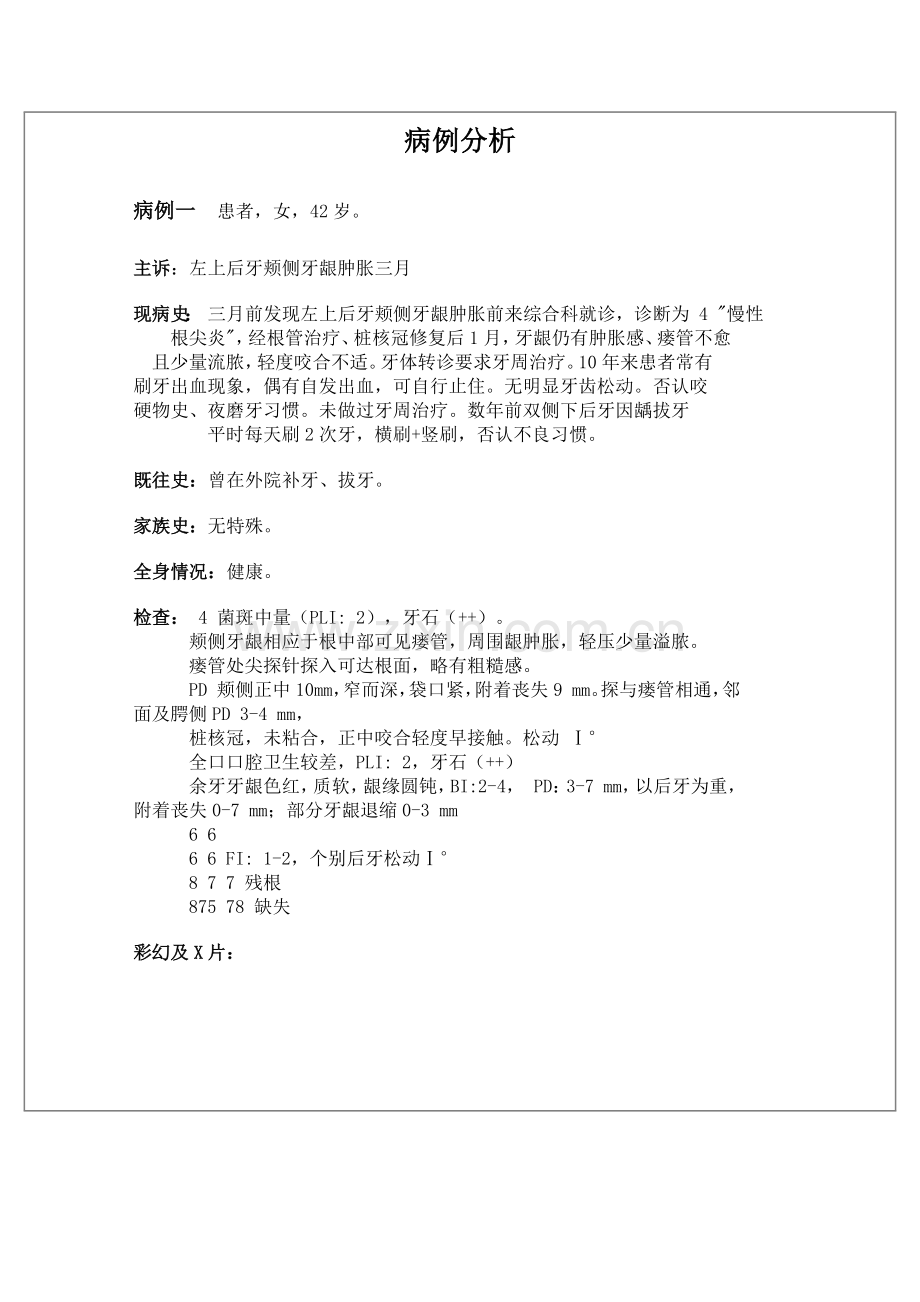 口腔医学院牙周病学-病例分析.doc_第1页