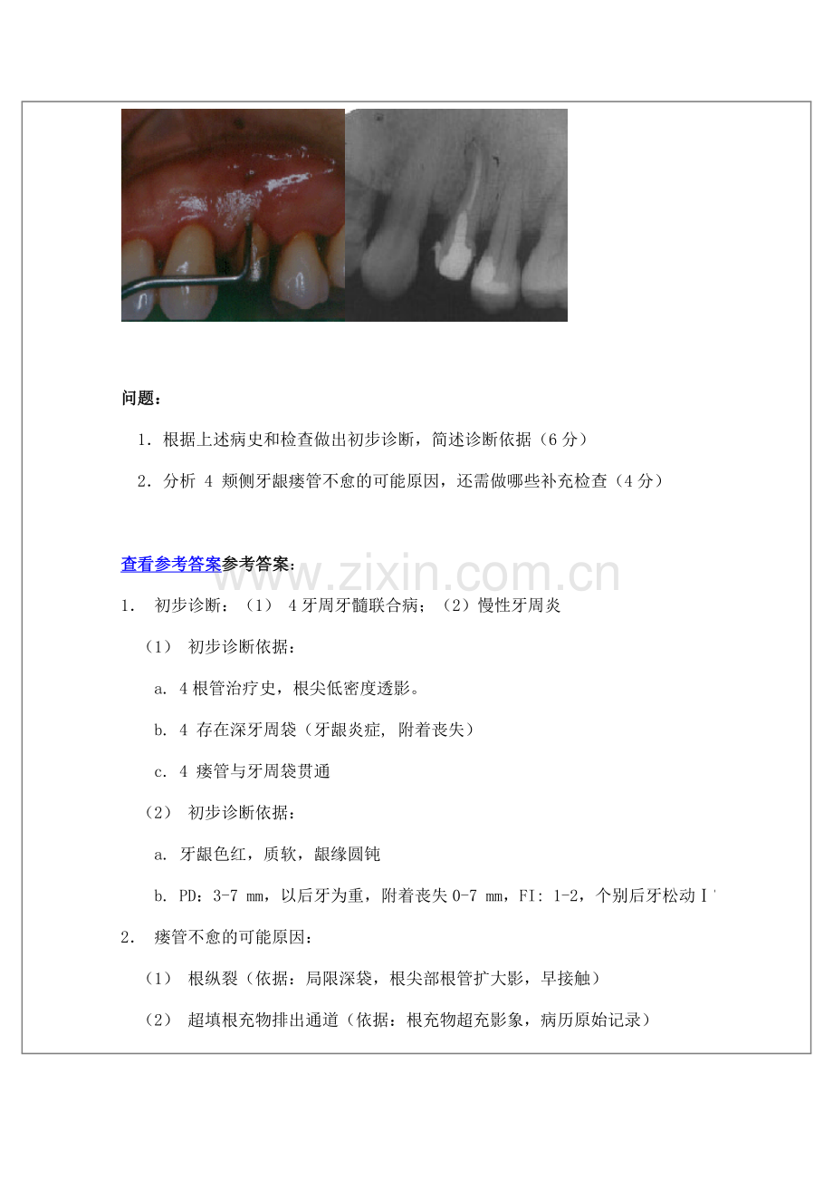 口腔医学院牙周病学-病例分析.doc_第2页